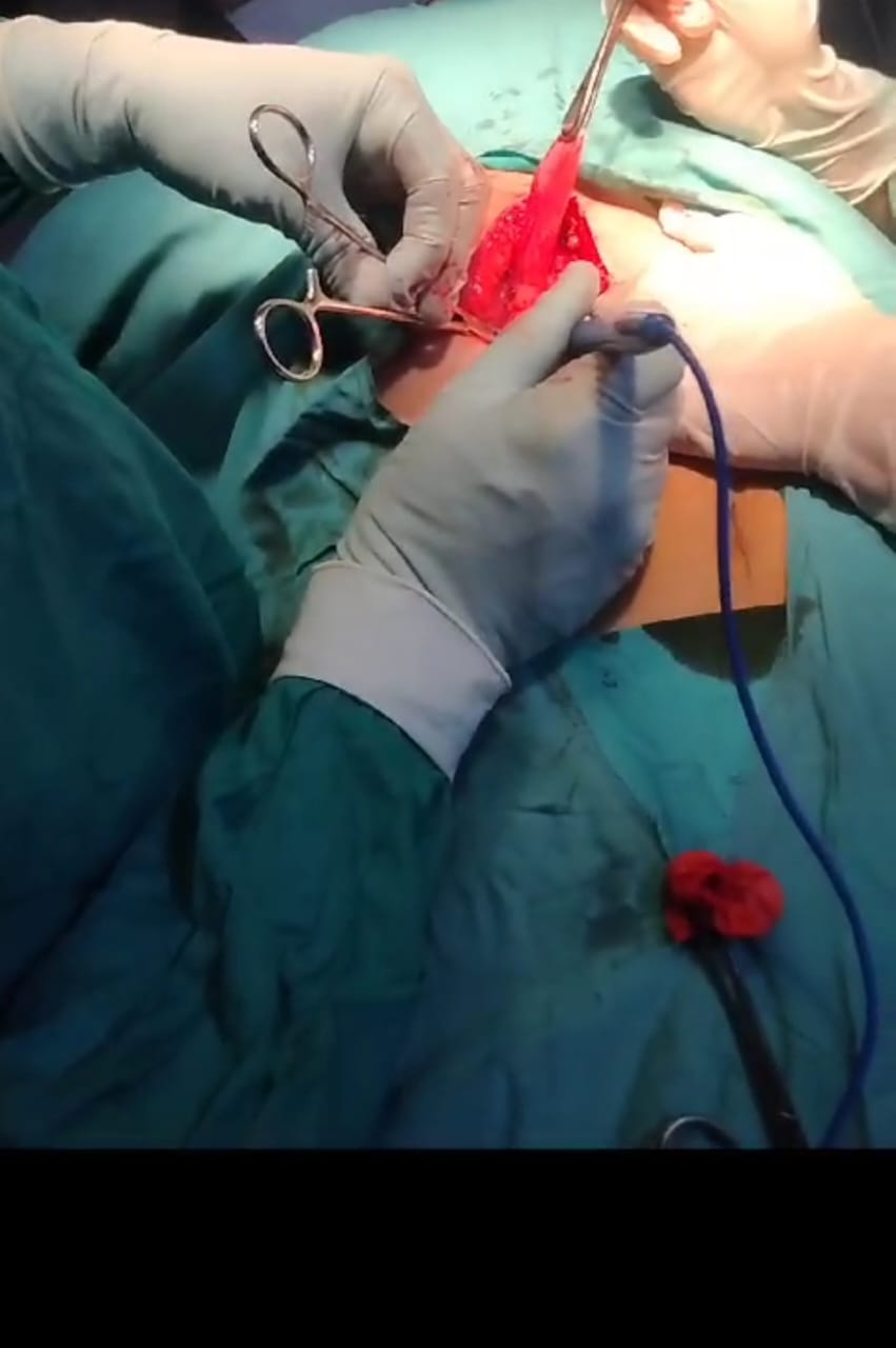 صحة اسيوط تجري 89 عملية مجانية الجمعة ضمن مبادرة 100 يوم صحة 