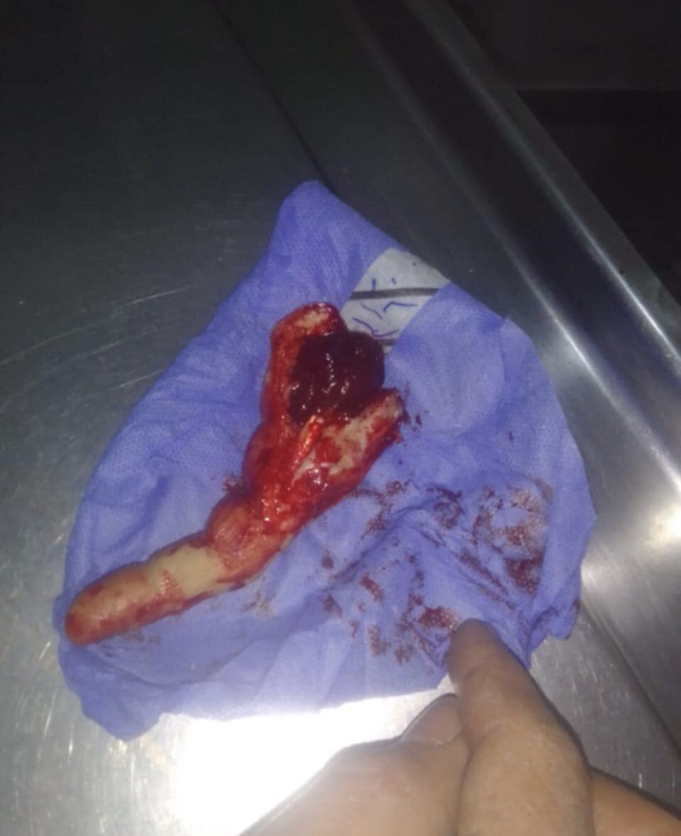 DEBDF80F-6034-49B4-974C-FBDD52C2613B