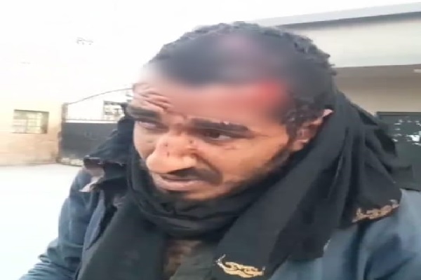 عامل النظافة - الضحية الأولى لبلطجي المطرية
