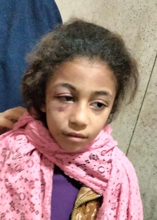 الابنة الكبرى أصيبت بإصابات متفرقة