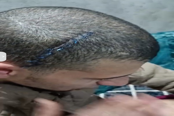 المجني عليه 