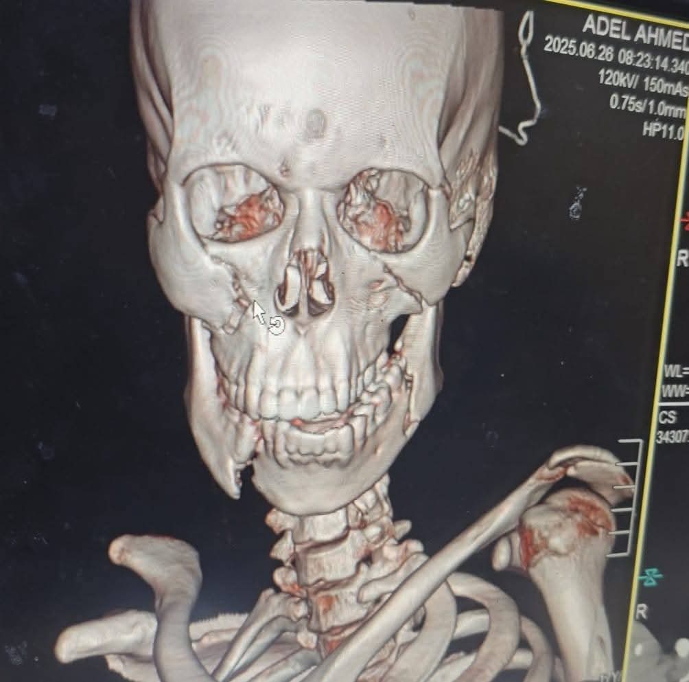 إجراء عملية جراحية ناجحة 