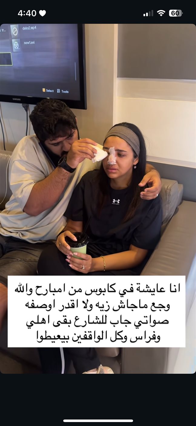 حقنة فيلر كنزي مدبولي