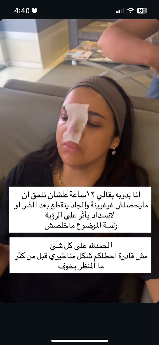 حقنة فيلر كنزي مدبولي