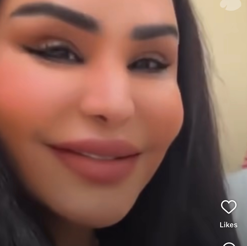 عملية تجميل أحلام