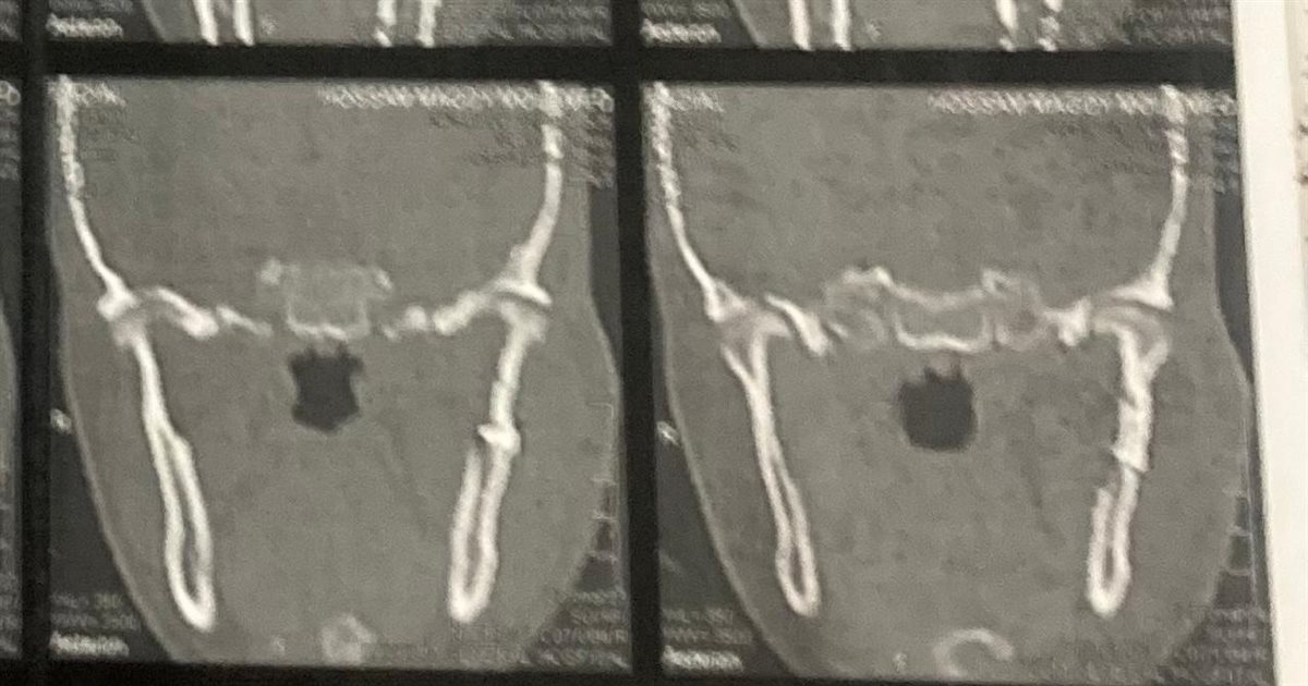 1000375727