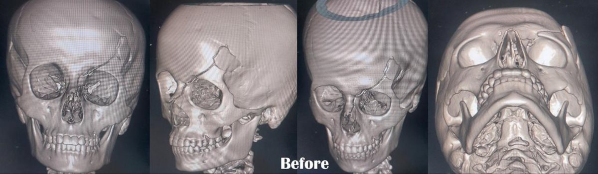 الوجه قبل اجراء الجراحة