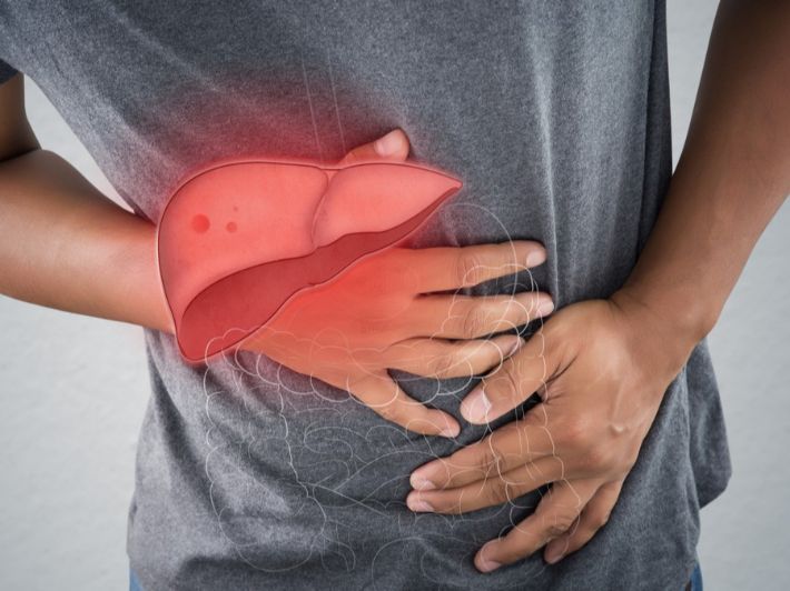 مرض <strong>تشمع الكبد</strong>