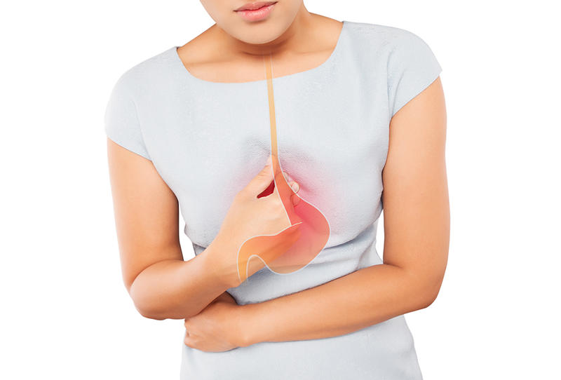 ارتجاع المعدة