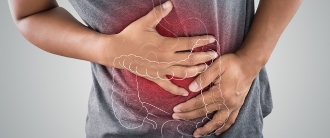 متلازمة القولون العصبي