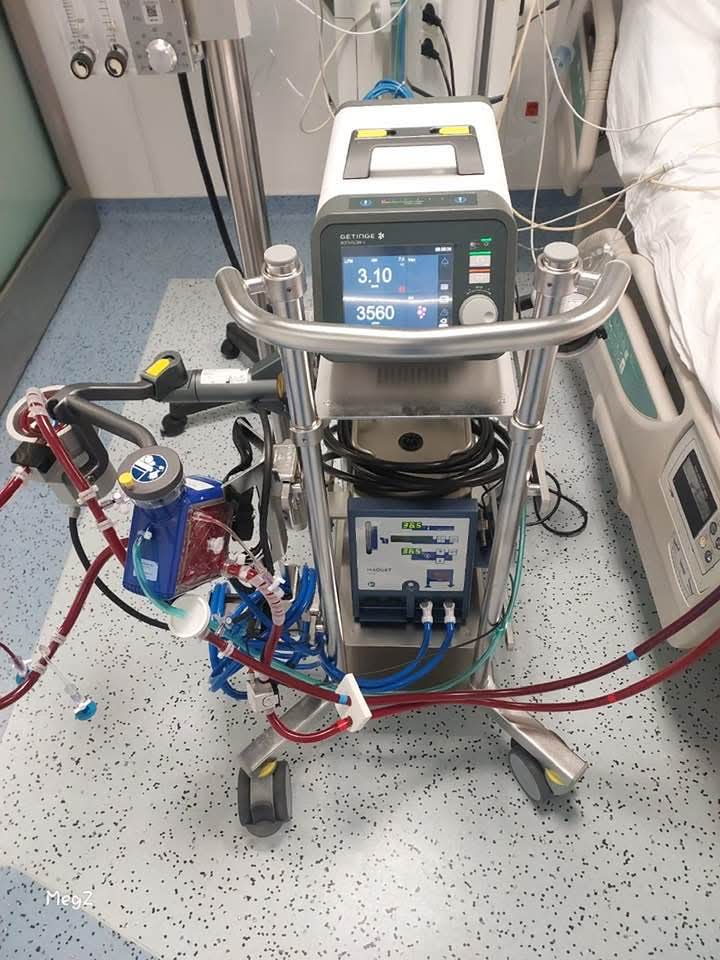 جهاز إيكمو في قصر العيني&nbsp;