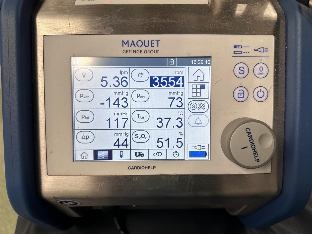 وحدة الإيكمو بقصر العيني&nbsp;