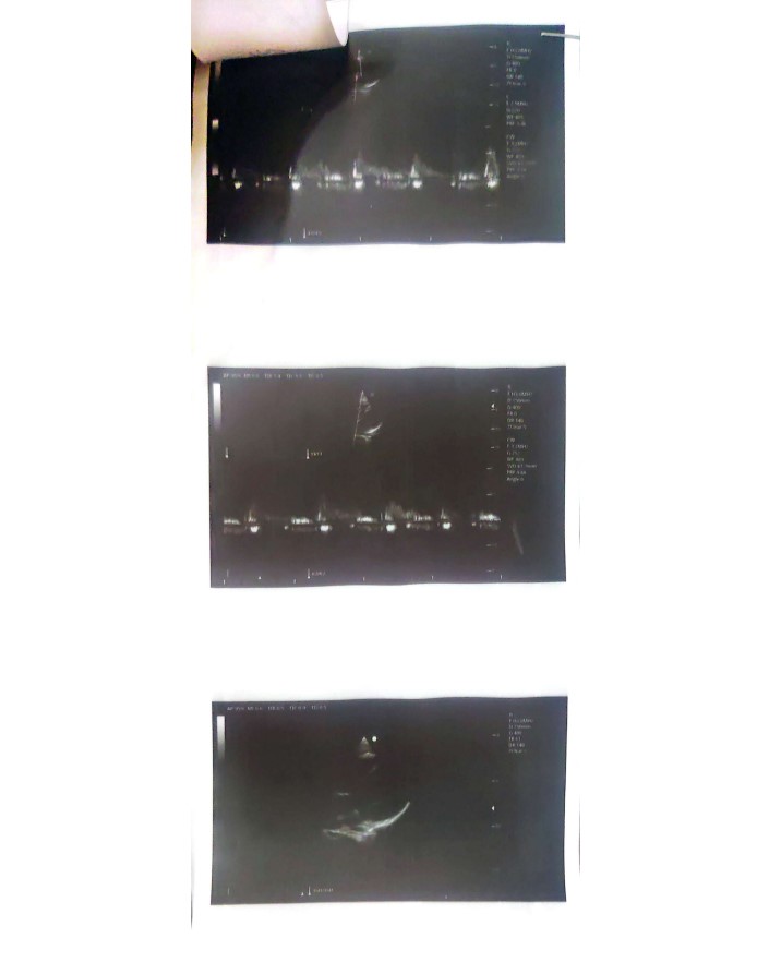 1000255424