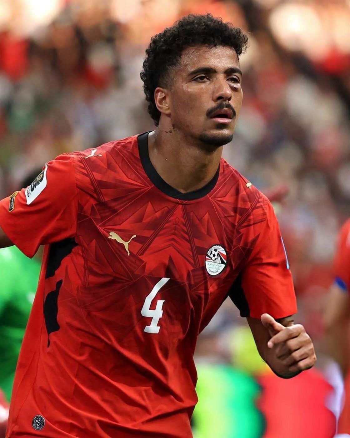 إصابة حسام عبدالمجيد