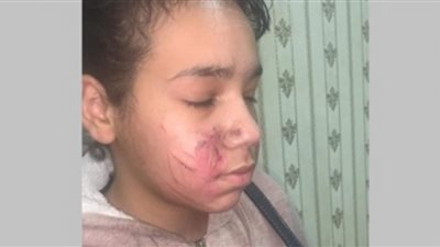قانوني يكشف عُقوبة الأب المتهم بتعذيب نجلته بأبو النمرس
