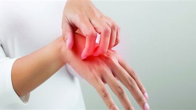 التسمم الشمسي.. 10 حقائق مجهولة عن أسبابه وطرق علاجه