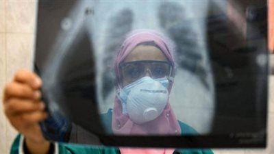خبير مناعة يوضح الوضع الوبائي للفيروس الفترة المقبلة بعد انخفاض إصابات كورونا