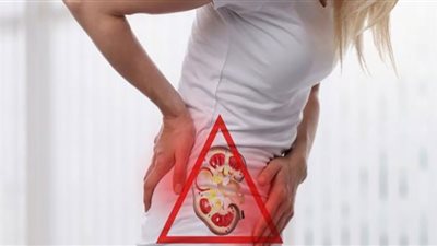 حصوات الكلى| أعراضها وأسباب حدوثها وطرق علاجها