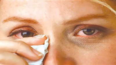 طبيبة عيون تكشف تأثير كورونا على النظر