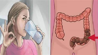 6 نصائح وعلاجات منزلية تساعد على تهدئة القولون العصبي