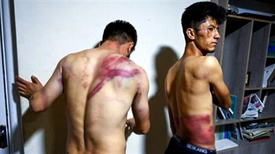 محظوظ بعدم قطع رأسك.. روايات مرعبة لصحفيين أفغانيين عذبتهما طالبان (فيديو)