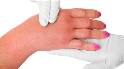 7 حيل سحرية لتقليل احتباس الماء في الجسم