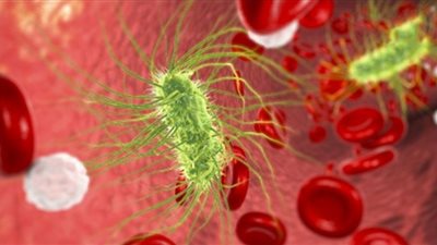 أعراض الإصابة بـ 