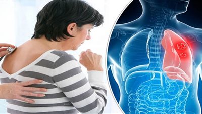 باستخدام أظافر السبابة.. اختبار جديد يكشف إصابتك بسرطان الرئة