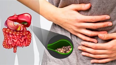 ما الأسباب وراء انسداد القناة الصفراوية؟