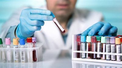 سبيد ميديكال تتعاقد على إجراء تحليل كورونا للعمالة المغادرة إلى ليبيا