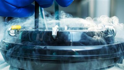 بعد تصريحات أروى جودة .. تعرف على حالات تجميد البويضات