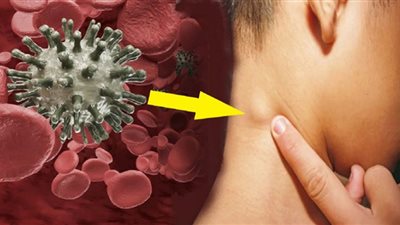 احذر.. 3 أعراض قاتلة لسرطان الدم يتجاهلها الناس