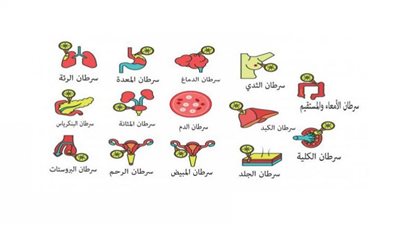 الأعراض المبكرة لأكثر 8 أنواع خطيرة من مرض السرطان.. (تعرف عليها)