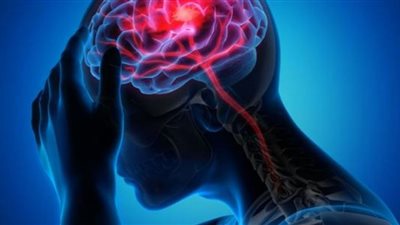 علاقة النوم بالسكتة الدماغية والمادة البيضاء