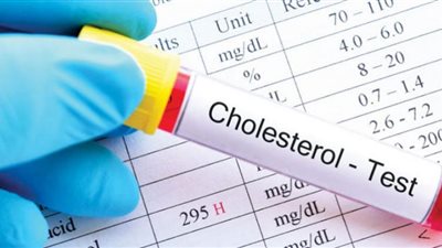 5 عادات لخفض نسبة الكوليسترول