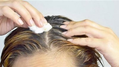 تمثل اضطرابًا صحيًا.. لا تتجاهل هذه العلامة في فروة الرأس
