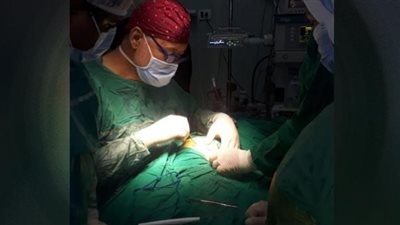 مستشفى المنيرة يجرى 450 جراحة دقيقة ونادرة للأطفال والمبتسرين خلال عام