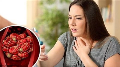 أخصائي مناعة يحذر: هذه الأطعمة ترفع خطر الإصابة بتجلطات الدم