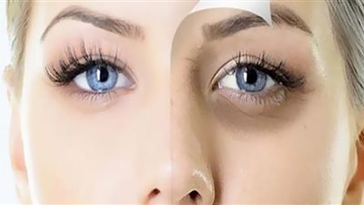 بجنية واحد.. تخلصي من الهالات السوداء