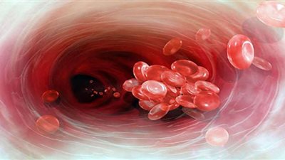 ما الأطعمة التي تحمي من تجلط الدم ؟