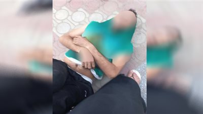 ضربوه علي رأسة 