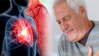 بعد وفاة شيرين دويك.. كيفية التعامل مع جلطات الشريان التاجي