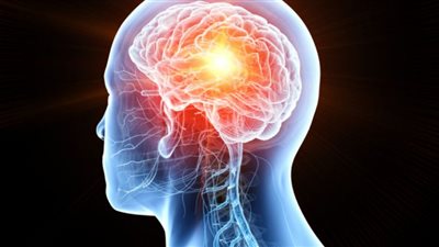 منها الصداع ومشاكل في الرؤية.. ماهي أعراض أورام الدماغ