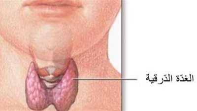 وزنها كيلو جرام ..إستئصال غدة درقية لسيدة مسنة في الاسكندرية
