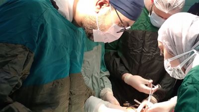 مستشفي كفر الدوار تنجح في عملية بزل لسائل متجمع حول القلب