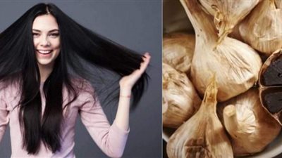أبرزها نمو الشعر.. 3 فوائد مذهله للثوم الأسود