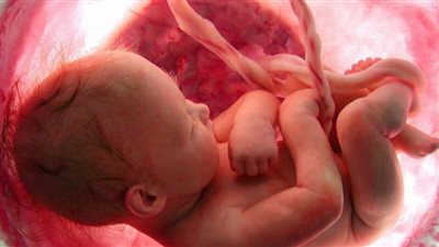 5 عوامل تسبب أخطاء في معرفة نوع الجنين
