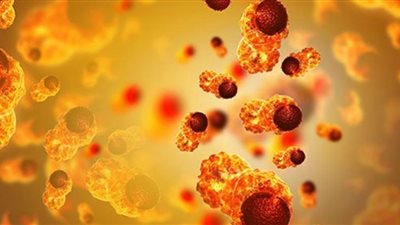 احذر.. ثلاث علامات تشير إلى إصابتك بالسرطان