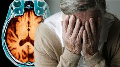 5 علامات تنذر عن إصابتك بمرض ألزهايمر المبكر