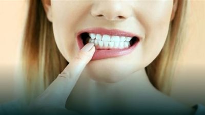 أسباب تفاقم حساسية الأسنان في الشتاء وطرق علاجها